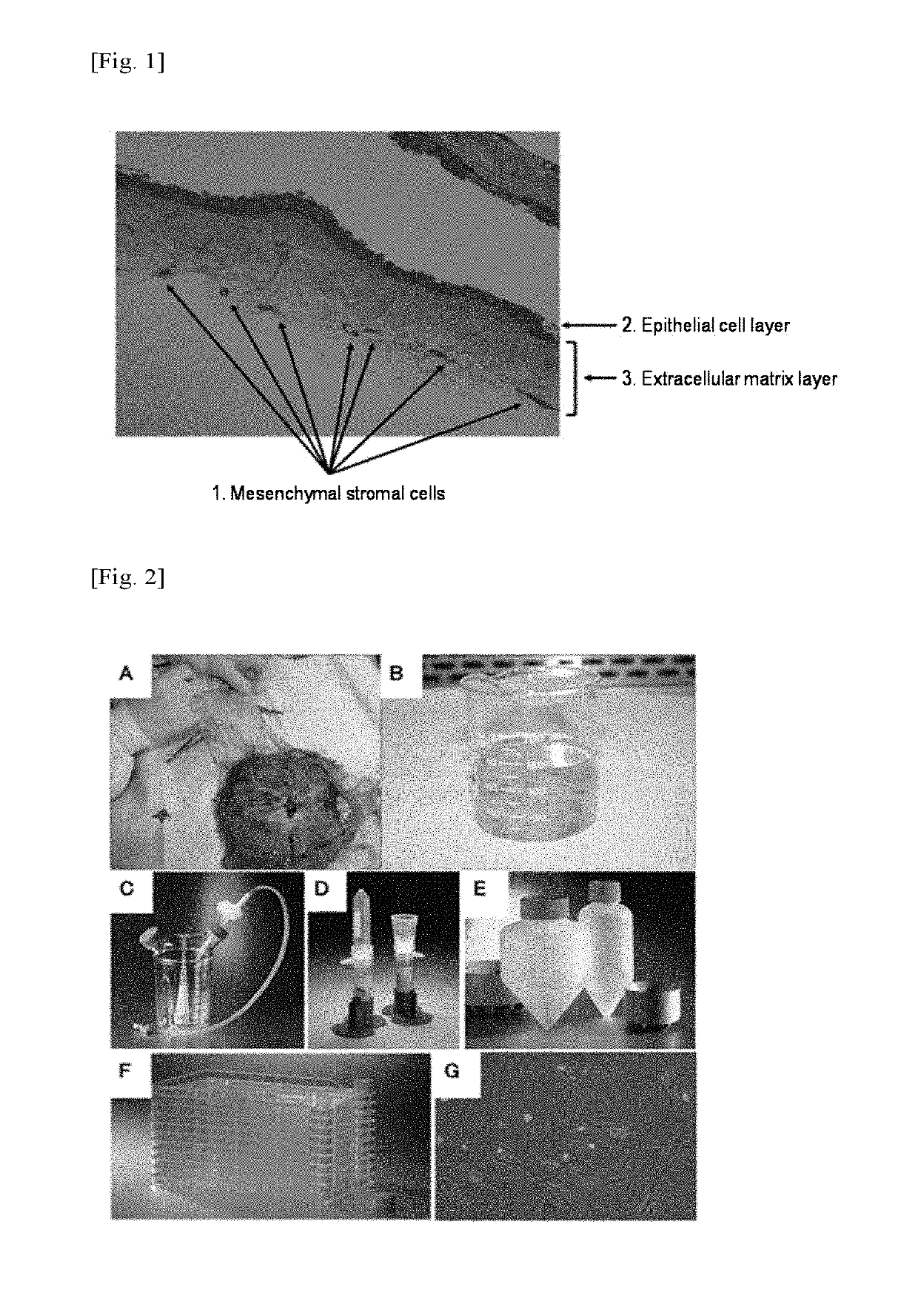 Method for producing amniotic mesenchymal stromal cell composition, method for cryopreserving the same, and therapeutic agent