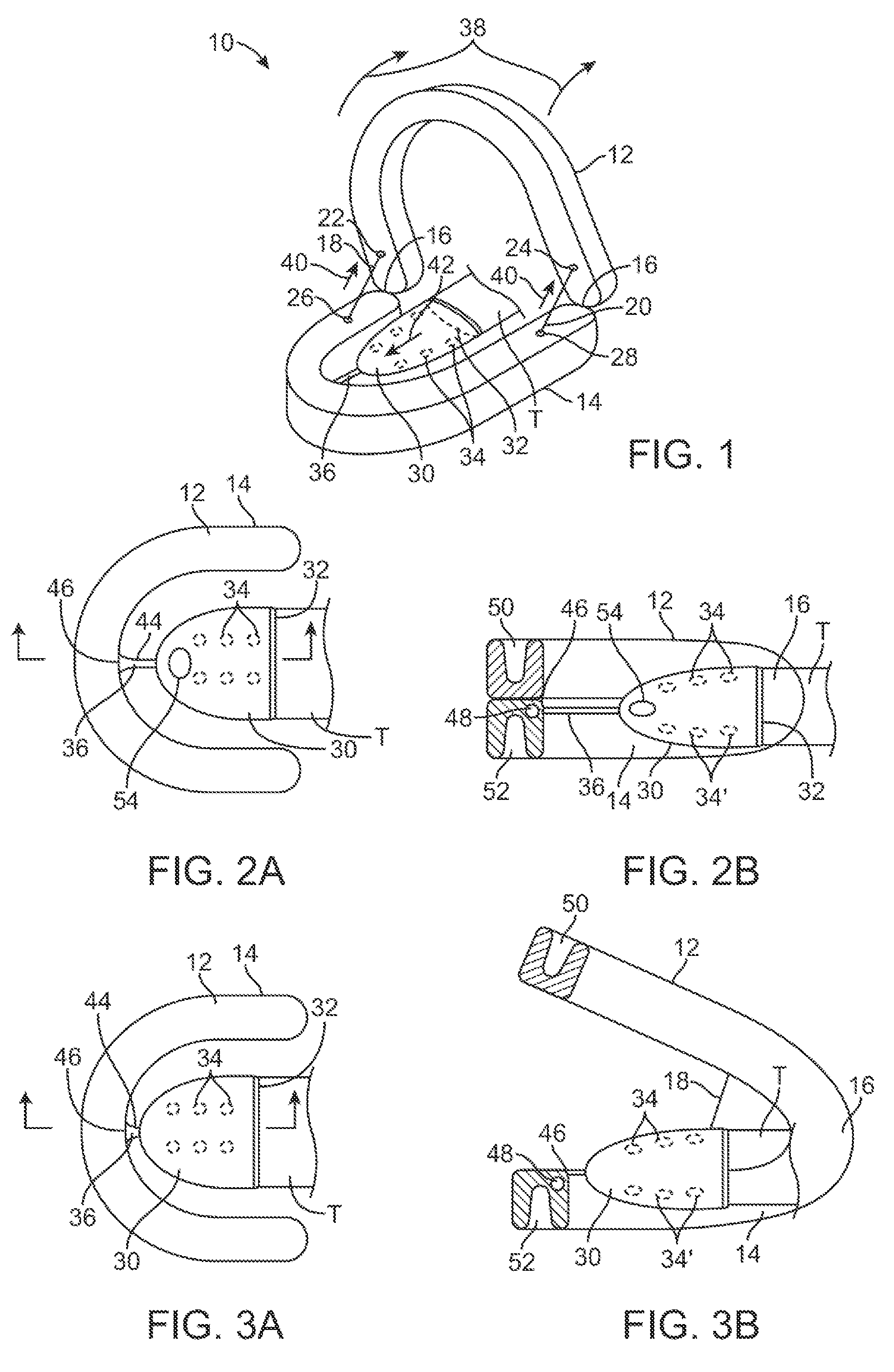 Variable automated tissue retention system