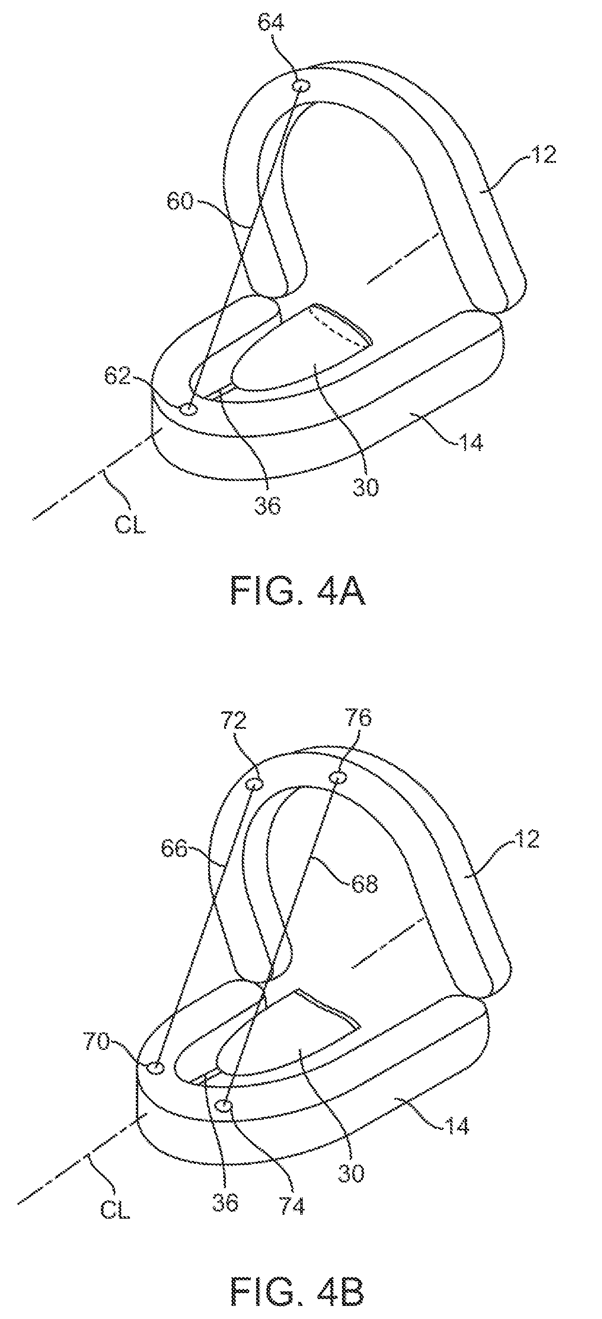 Variable automated tissue retention system