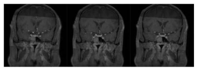 Method for establishing enhanced three-dimensional model for intracranial angiography