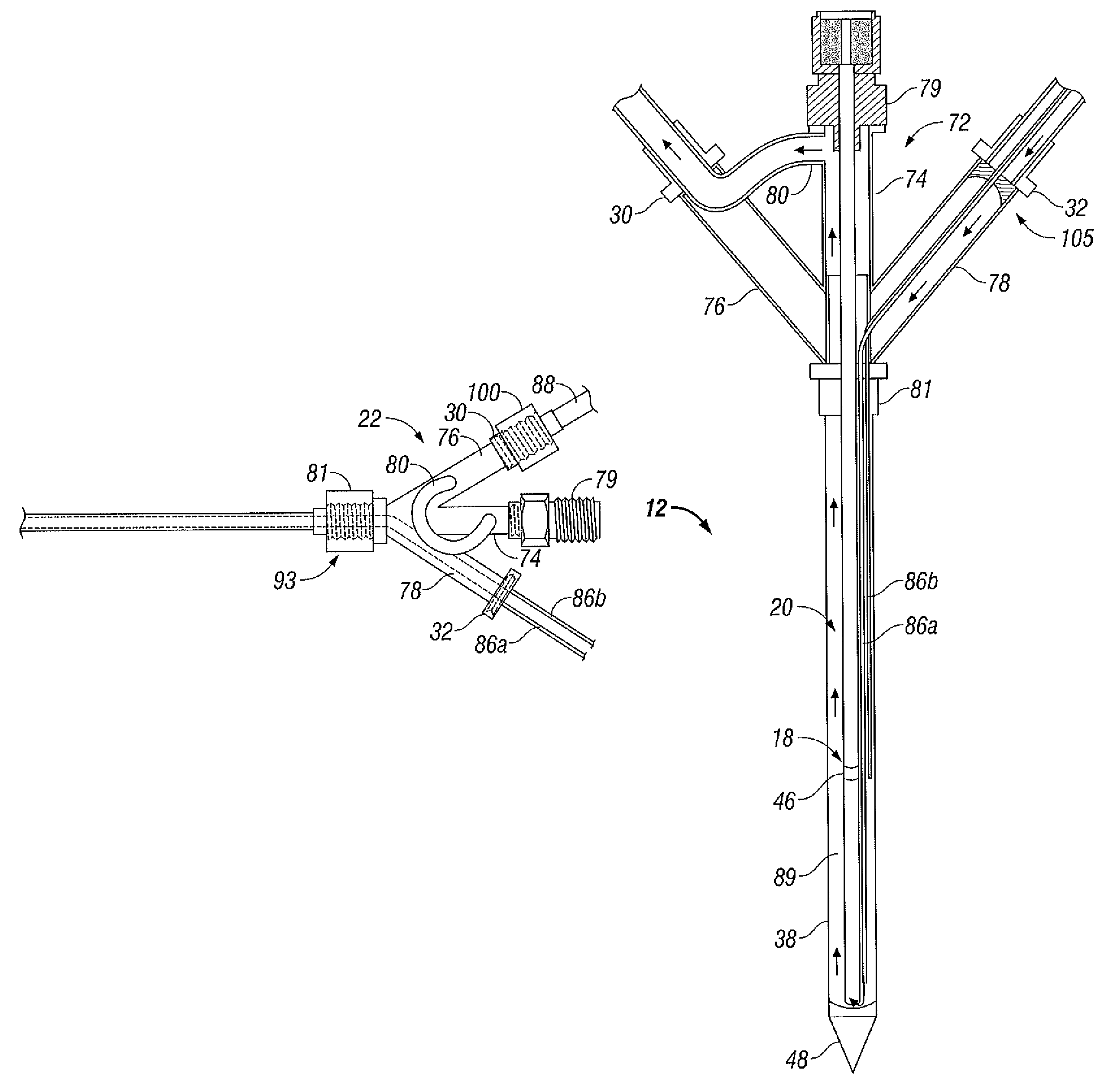 Microwave antenna