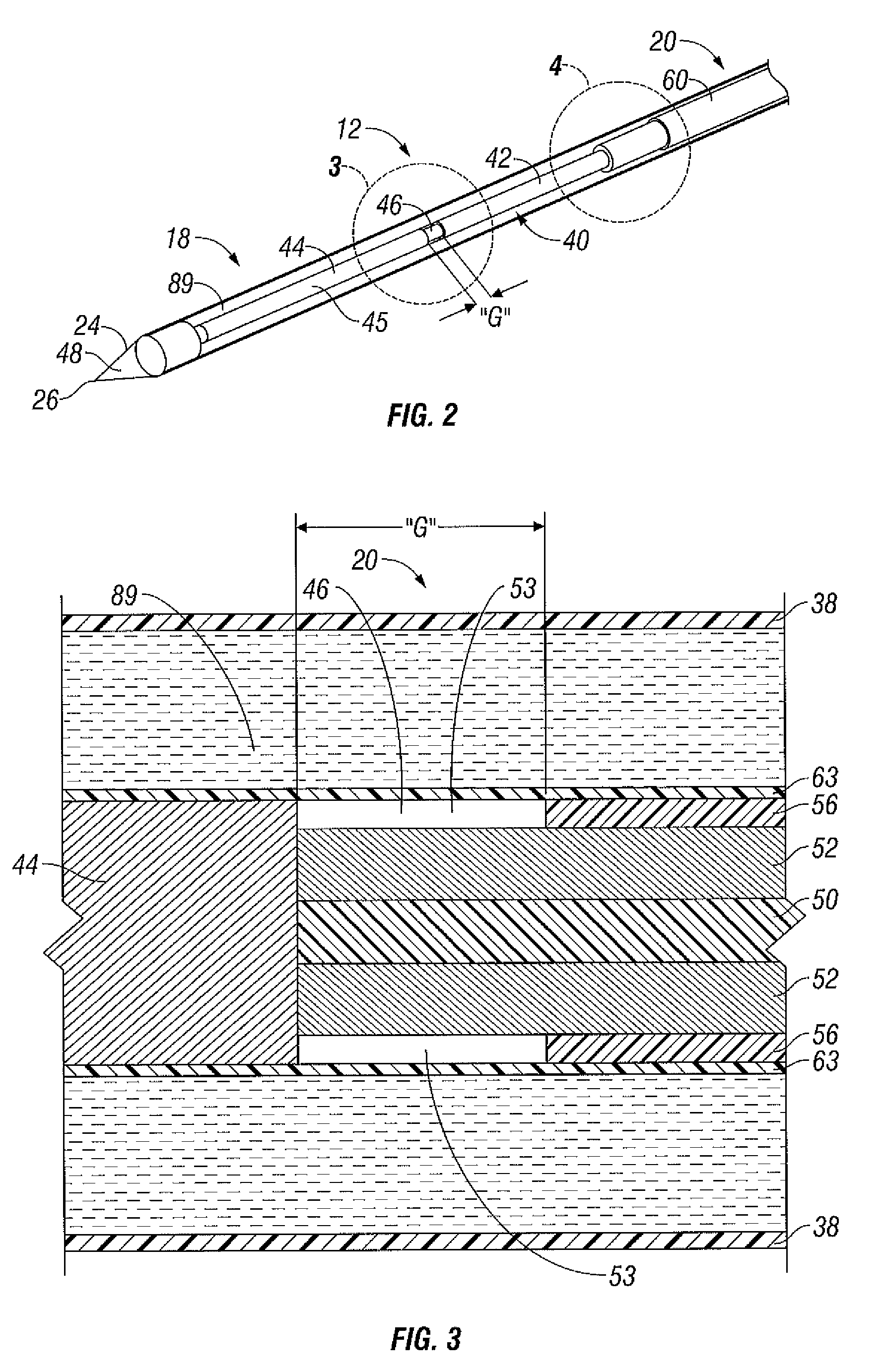 Microwave antenna