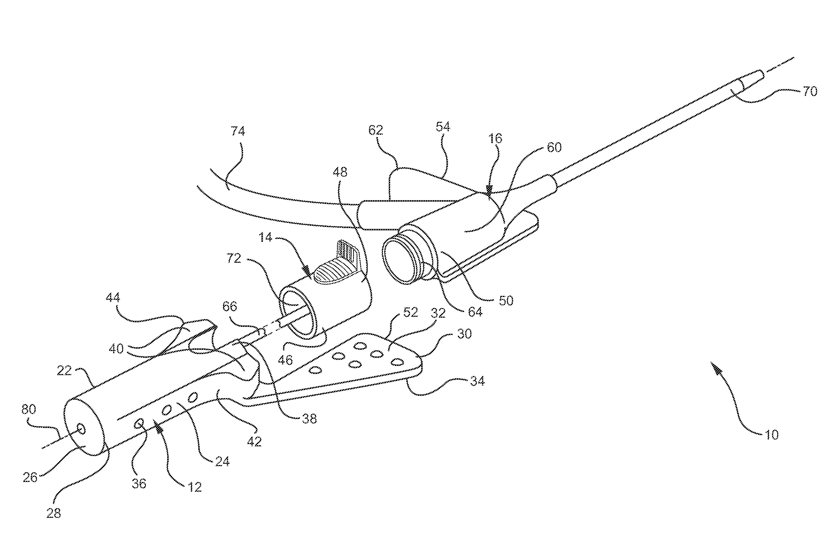 Systems and methods for providing a safety integrated catheter with universal grip