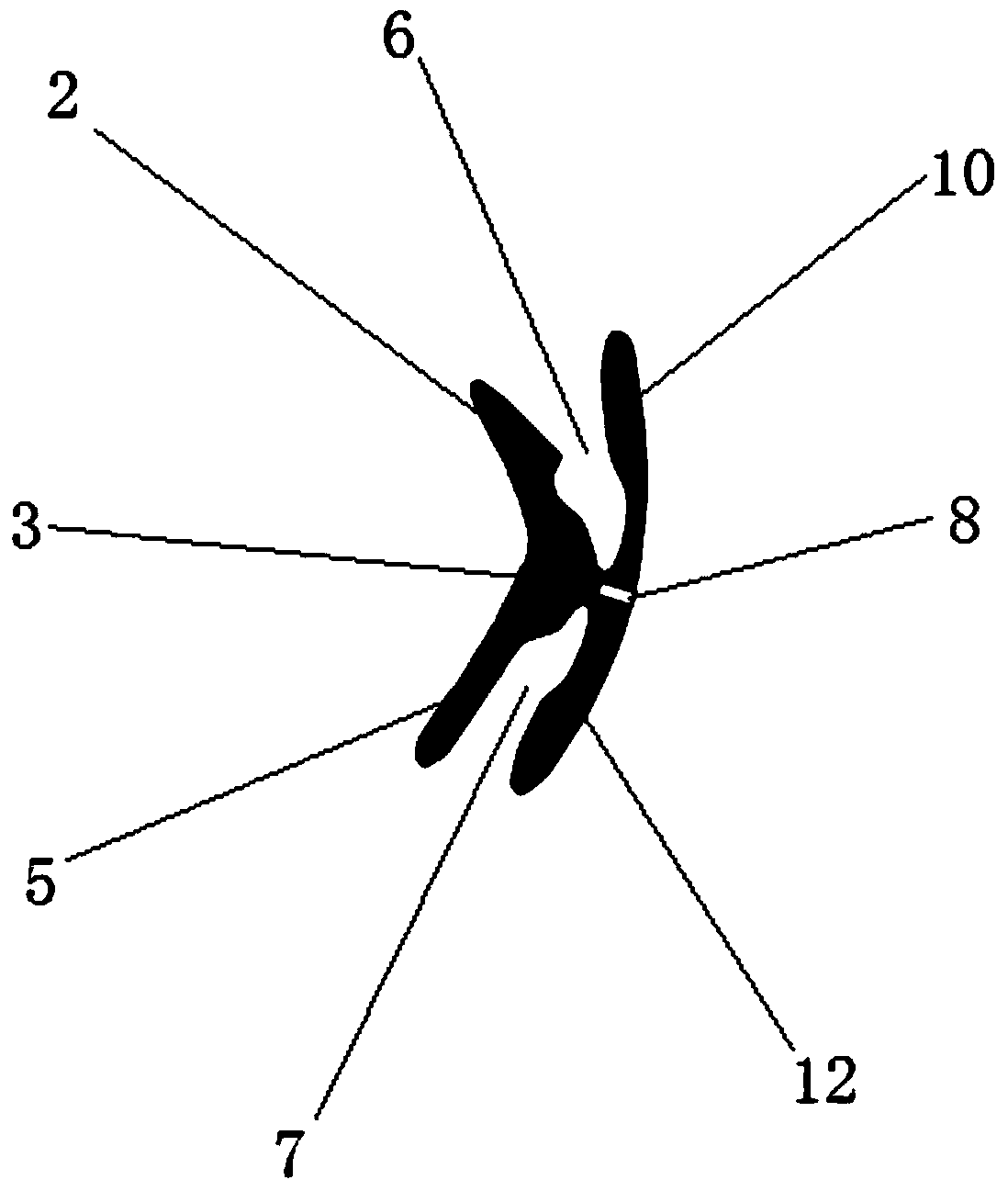 A type II personalized functional appliance and its manufacturing method and application