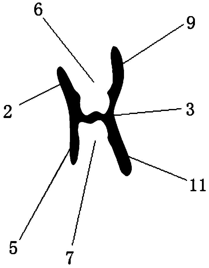 A type II personalized functional appliance and its manufacturing method and application