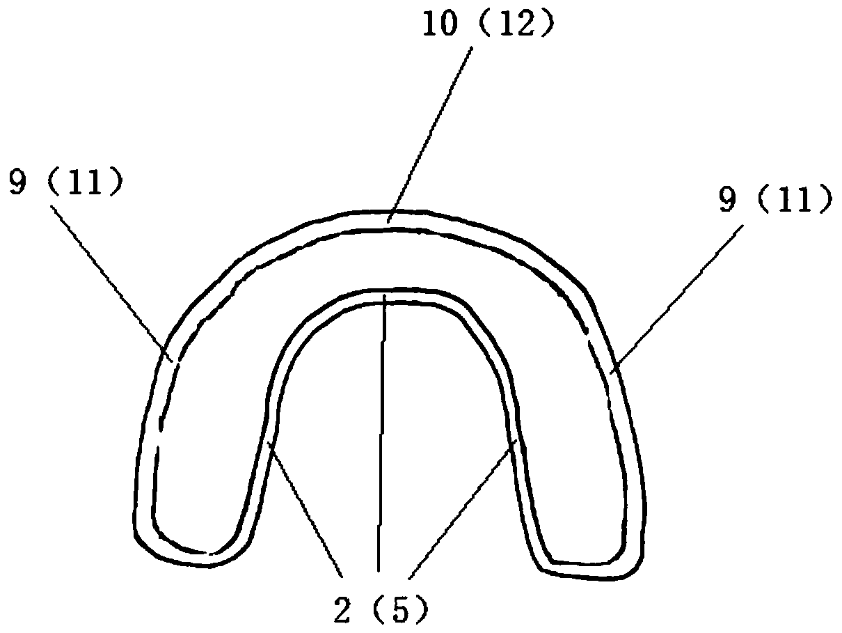 A type II personalized functional appliance and its manufacturing method and application