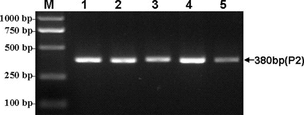 Detection method of Chinese simmental cattle carcass and meat quality trait genetic markers