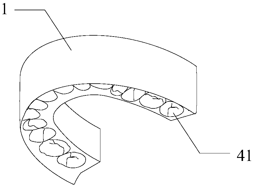 Tooth arrangement device and tooth arrangement kit, as well as preparation method and application thereof