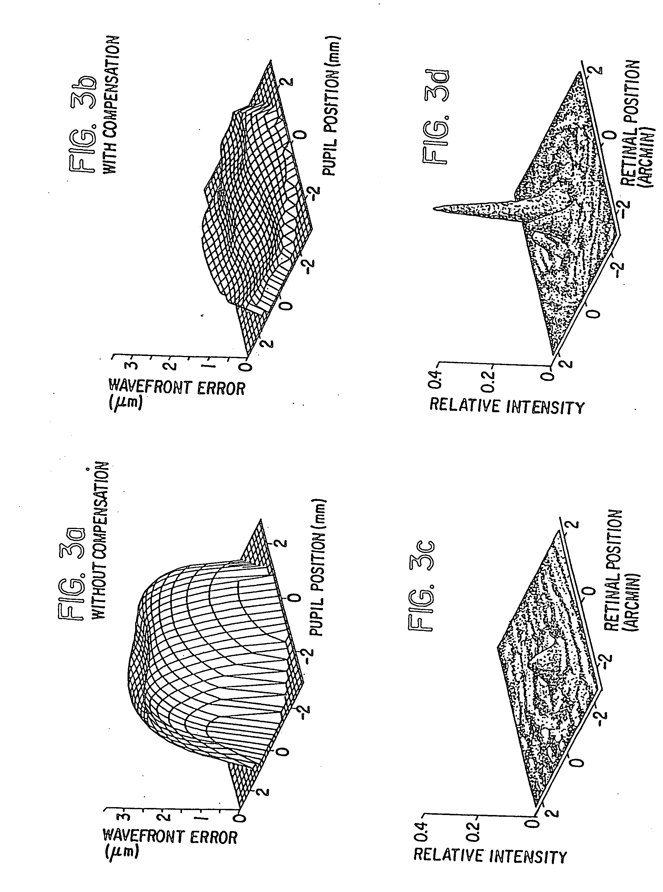 Method and apparatus for improving vision and the resolution of retinal images