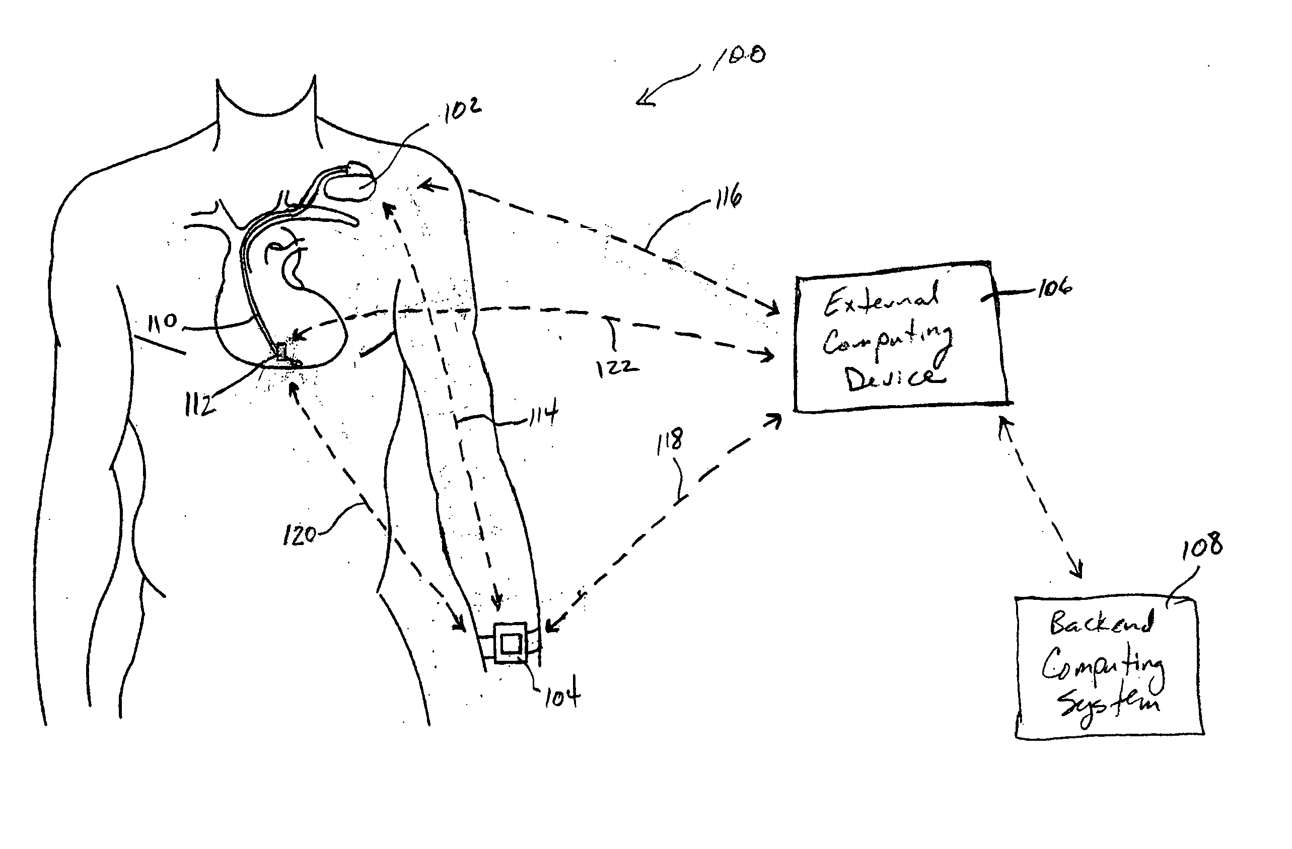 Systems and methods for deriving relative physiologic measurements using an implanted sensor device