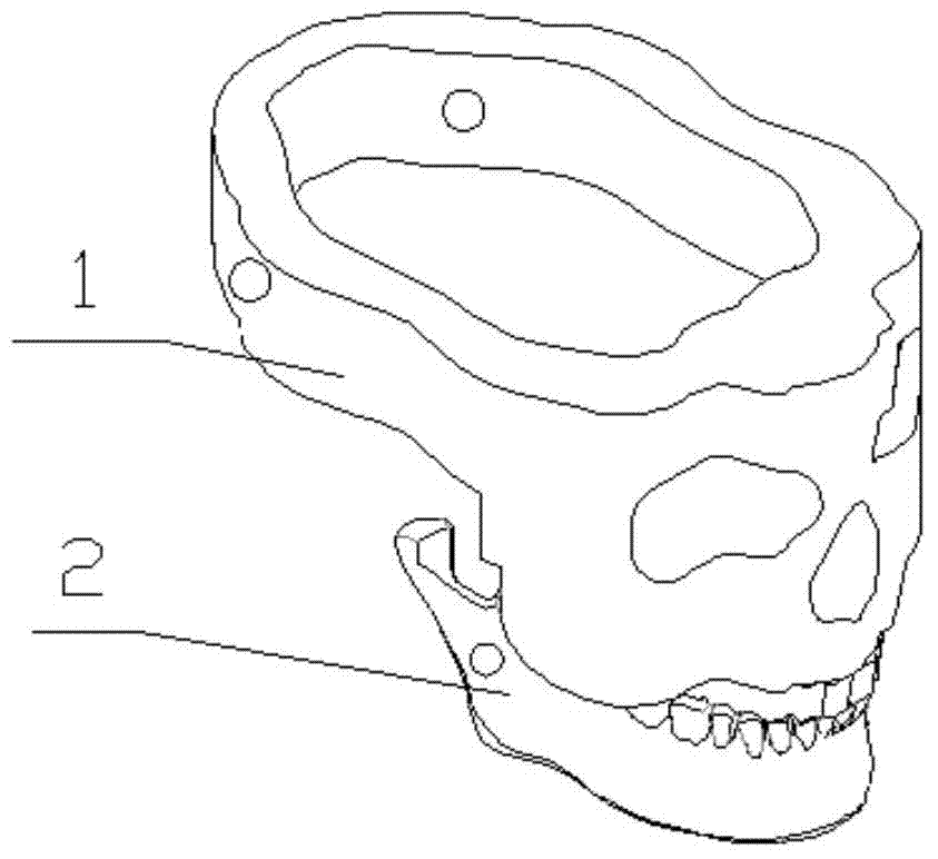 Redundant actuation chewing robot with bionic temporal-mandibular joint