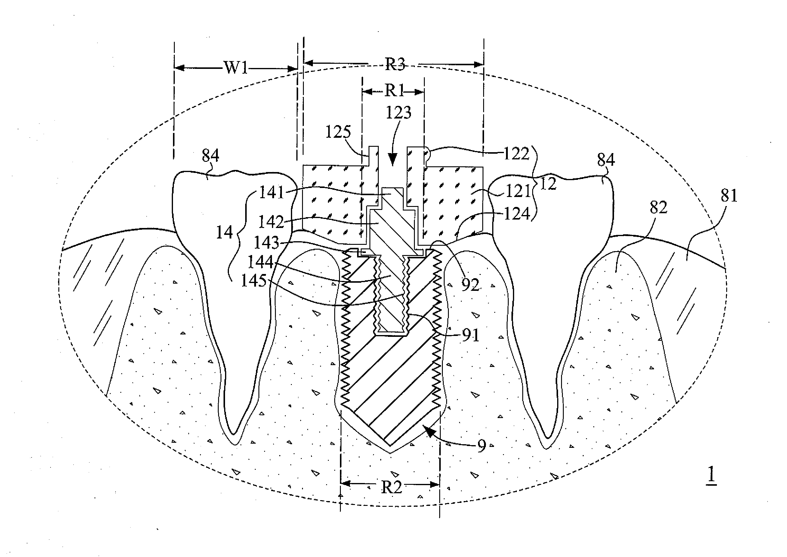 Multi Functional Implanting Suite and Implanting Method Thereof