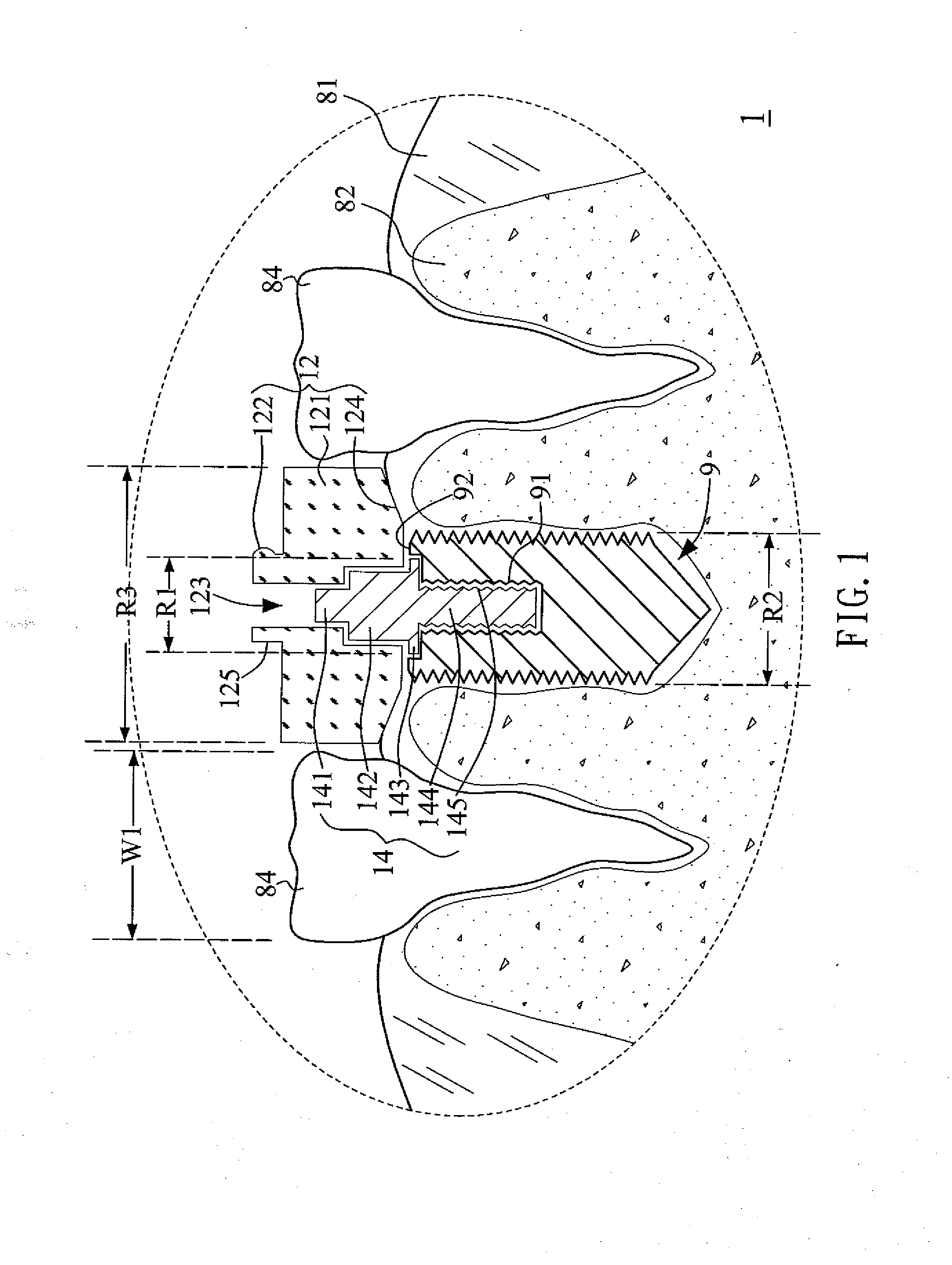 Multi Functional Implanting Suite and Implanting Method Thereof