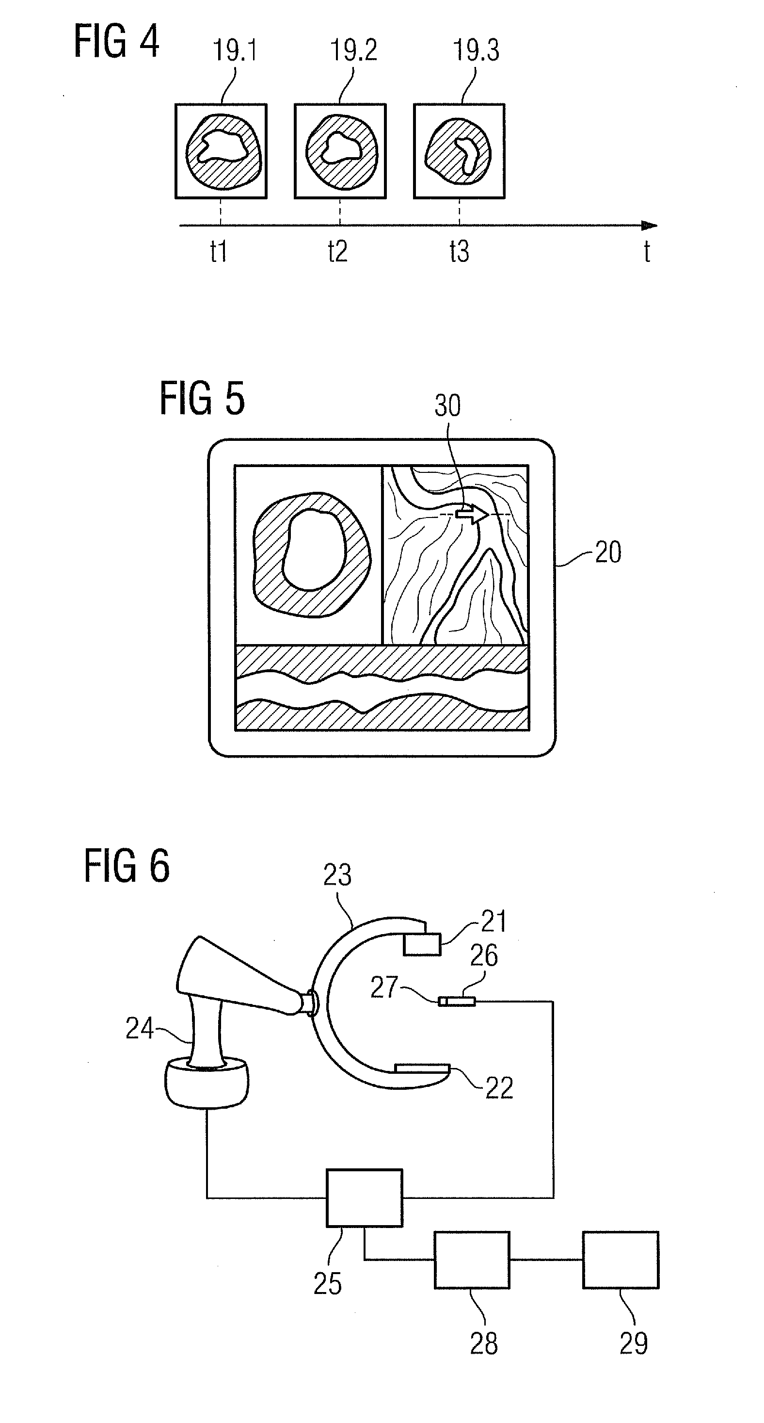 Visualization Method and Imaging System