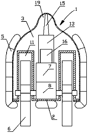 A root stone detection system