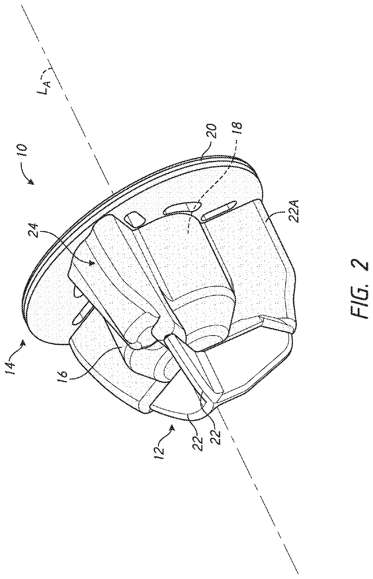 Patient specific stemless prosthesis anchor components