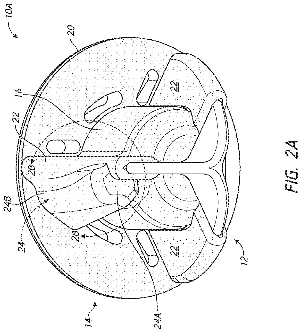 Patient specific stemless prosthesis anchor components