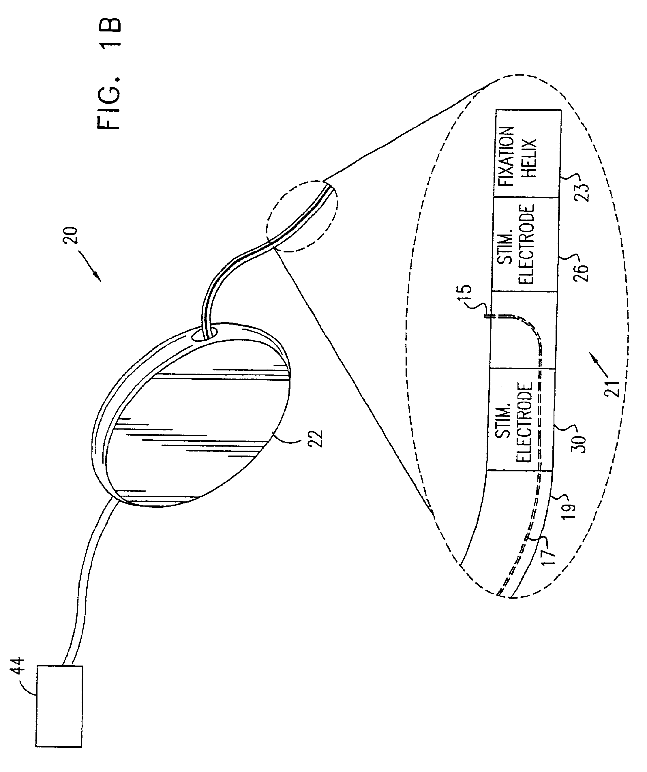 Pelvic disorder treatment device