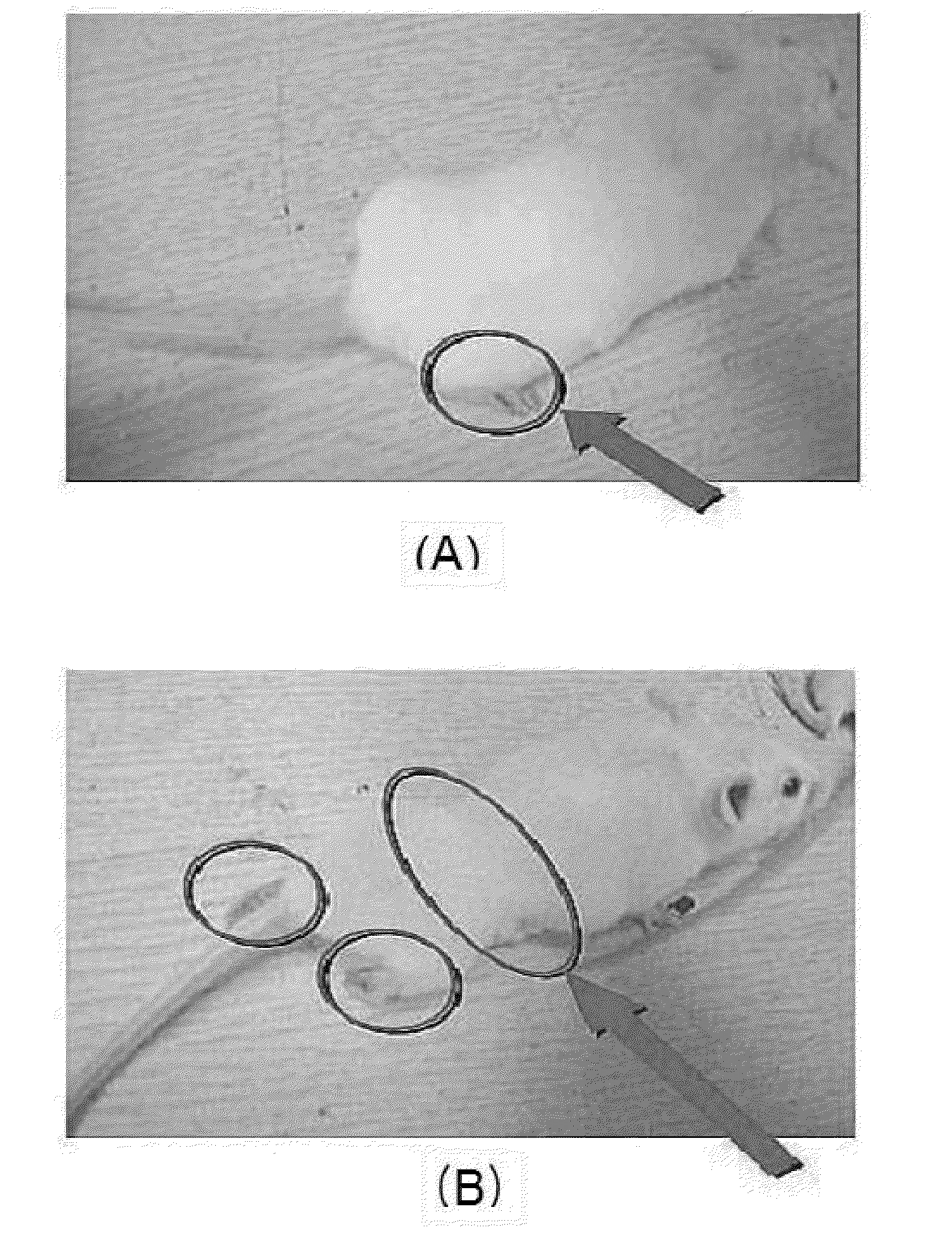 Non-diffusive botulinum toxin causing local muscle paralysis, and purification method thereof