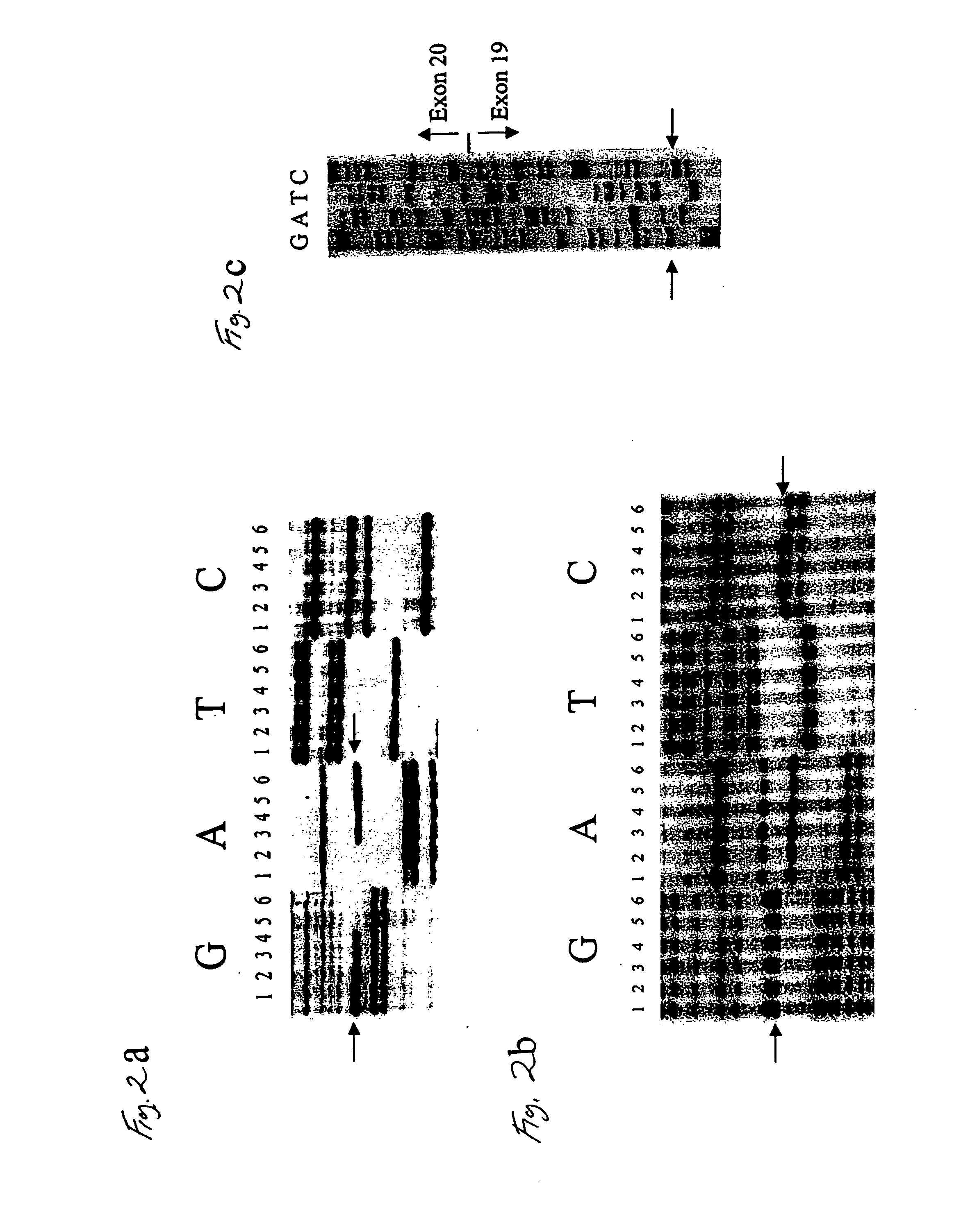 Gene for identifying individuals with familial dysautonomia