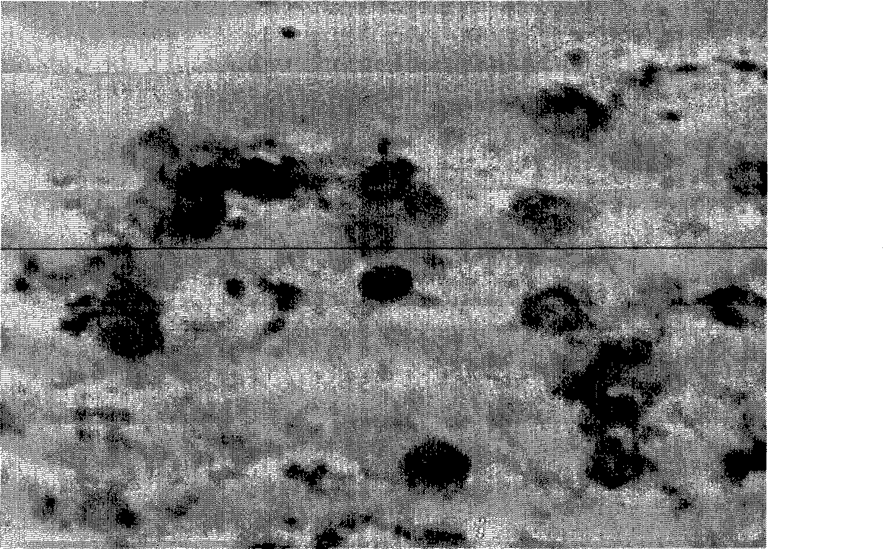 Comprehensive detection kit for early carcinoma of prostate, detecting method and use thereof