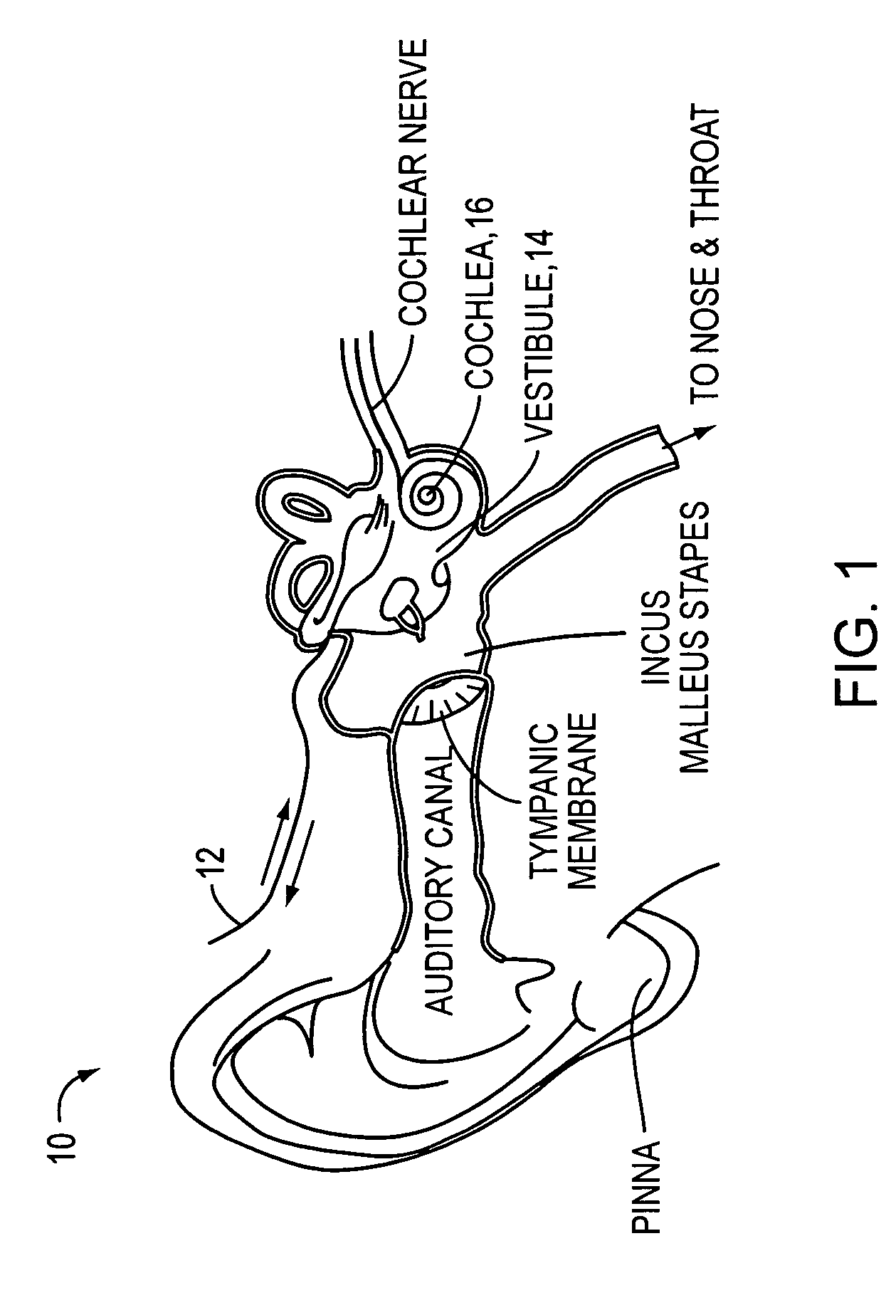 Drug delivery apparatus