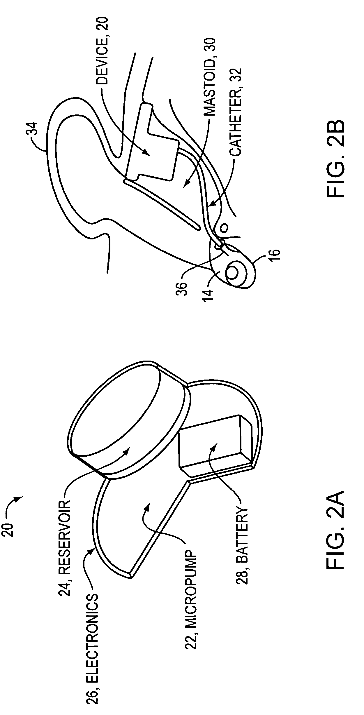 Drug delivery apparatus