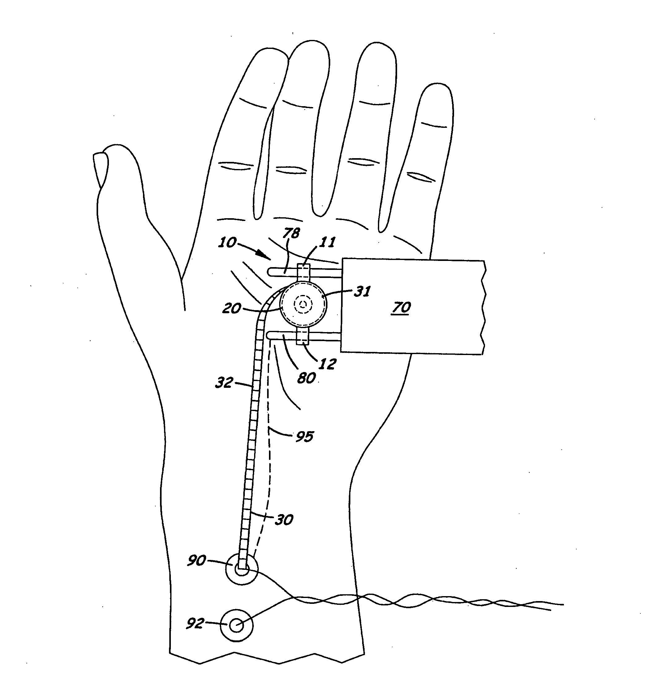 Nerve stimulator measuring device