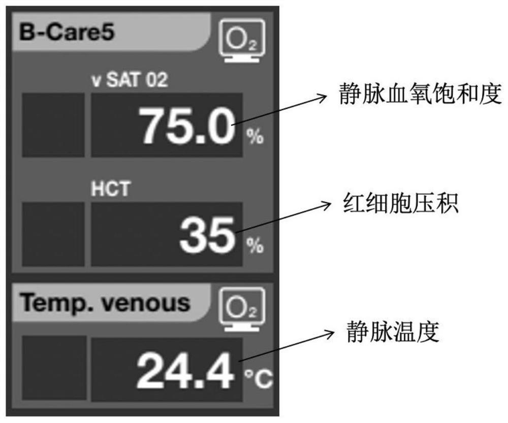 Artificial heart-lung machine data recording method based on artificial neural network technology