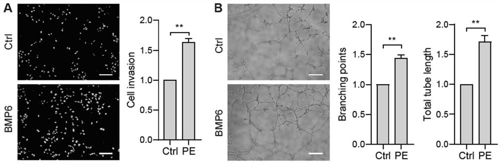 Application of bone morphogenetic protein 6 in early diagnosis, prevention and treatment of preeclampsia