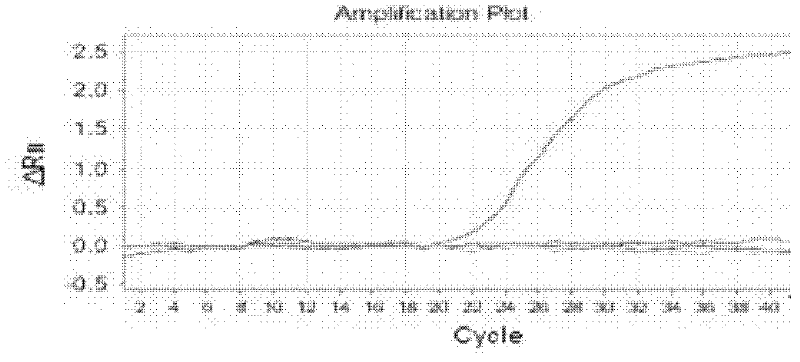 Fluorescence PCR (polymerase chain reaction) kit for detecting yersinia enterocolitica