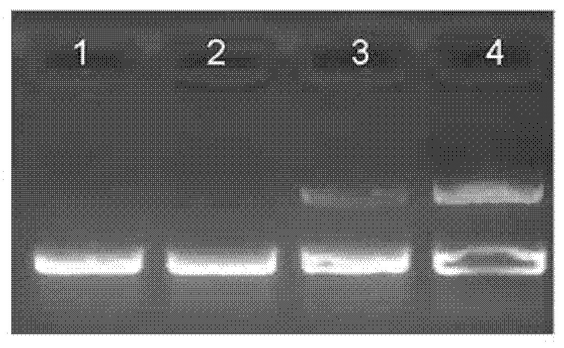 Soybean cyst nematode resistance gene and application thereof