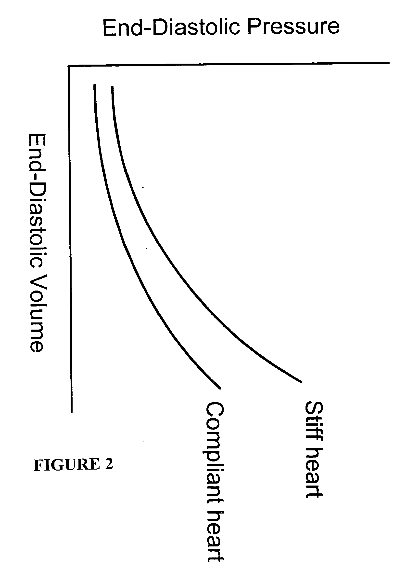 Systems and methods for making noninvasive assessments of cardiac tissue and parameters