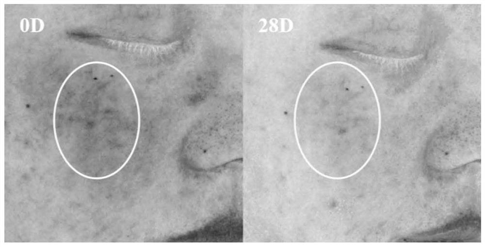 Repairing and soothing skin care product containing metagen component and preparation method thereof