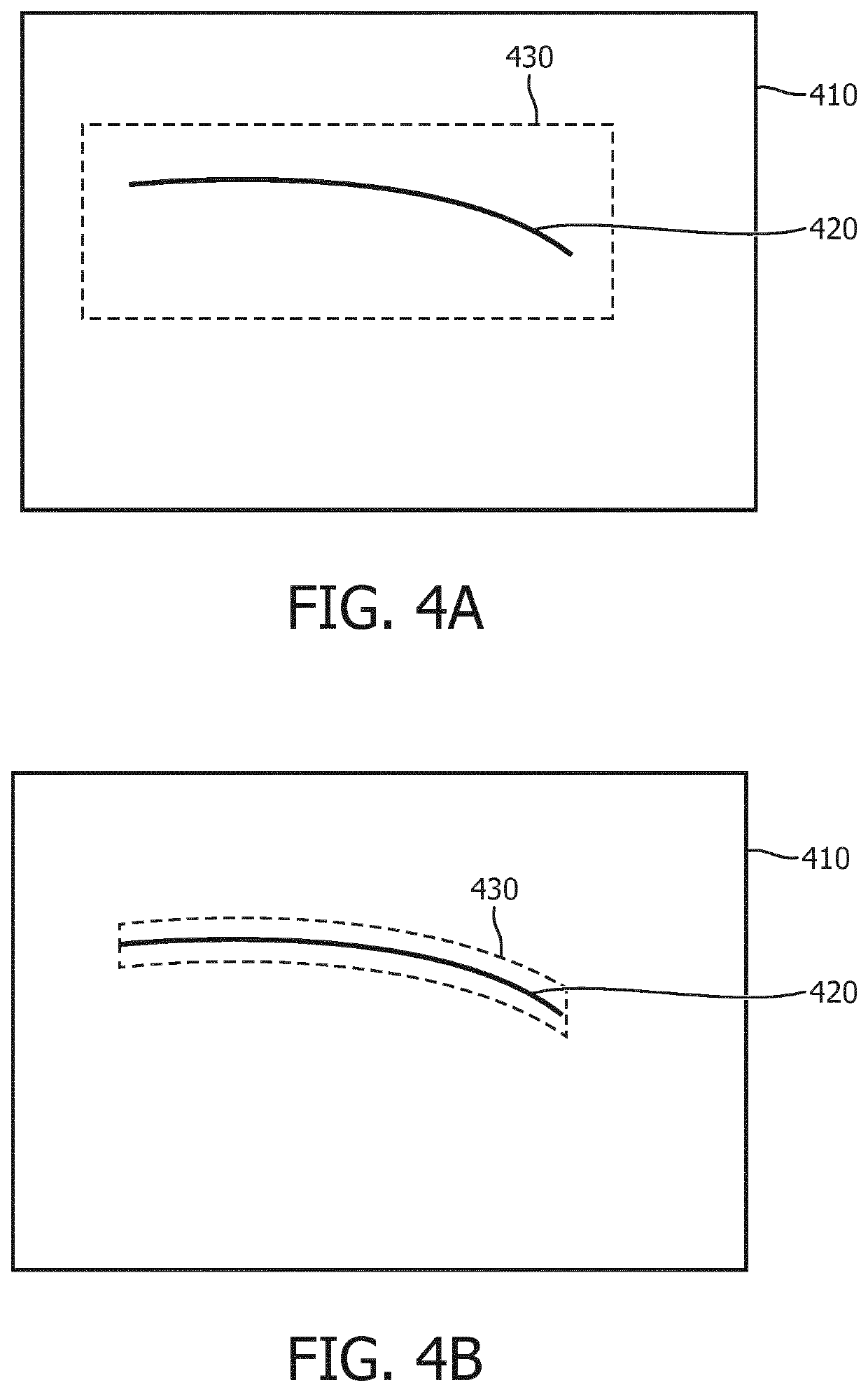 Apparatus and method for detecting bone fracture