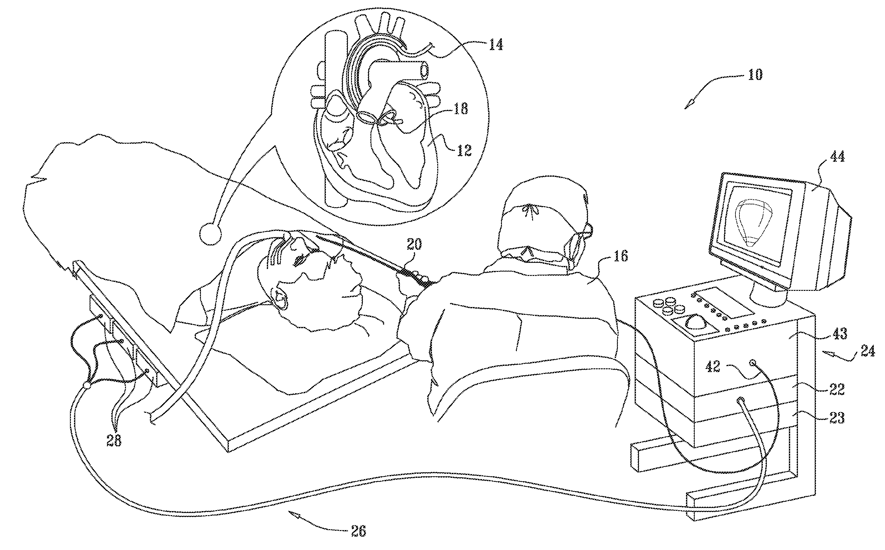 Automated pace-mapping for identification of cardiac arrhythmic conductive pathways and foci