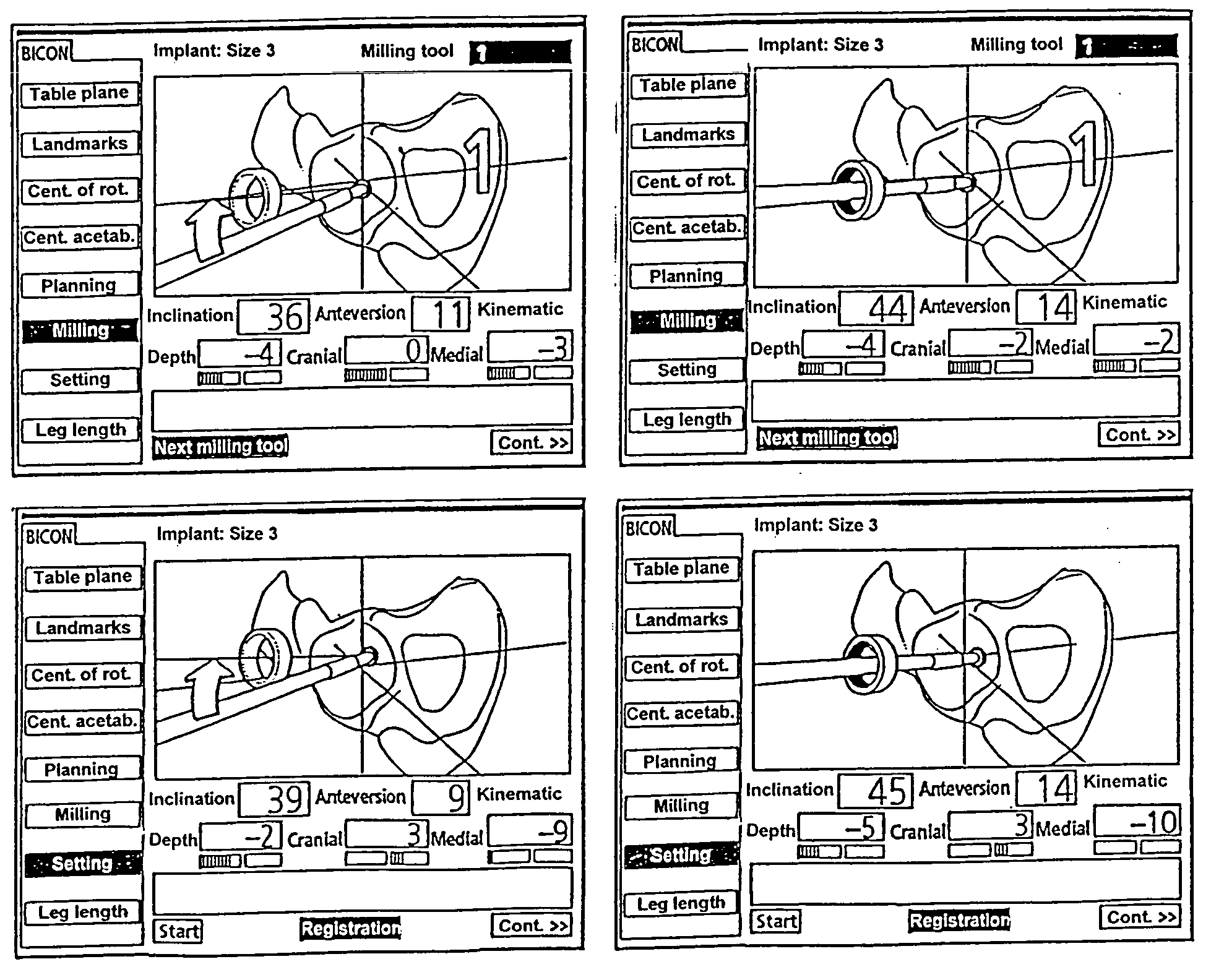 Arrangement for ascertaining function-determining geometric parameters of a joint of a vertebrate