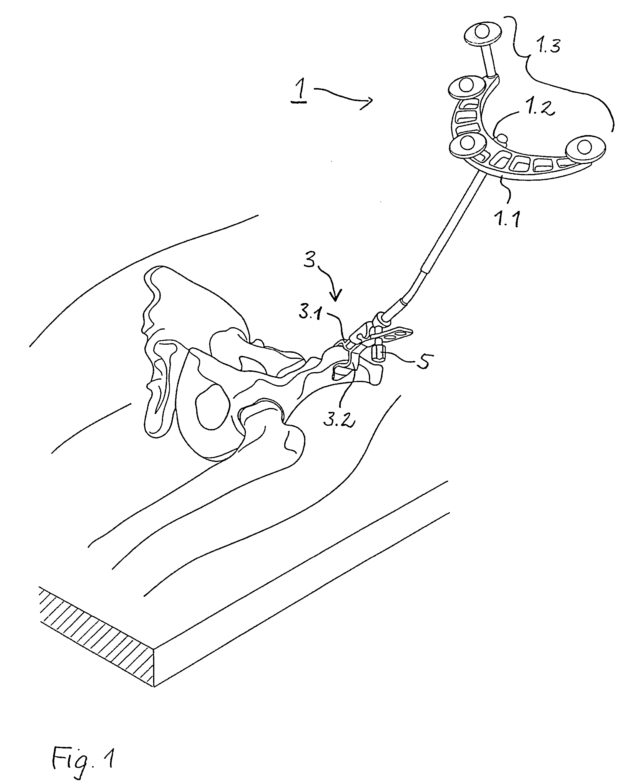 Arrangement for ascertaining function-determining geometric parameters of a joint of a vertebrate