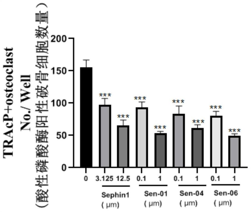 Substituted guanidyl-containing derivative and application thereof in preparation of osteoclast differentiation inhibitor