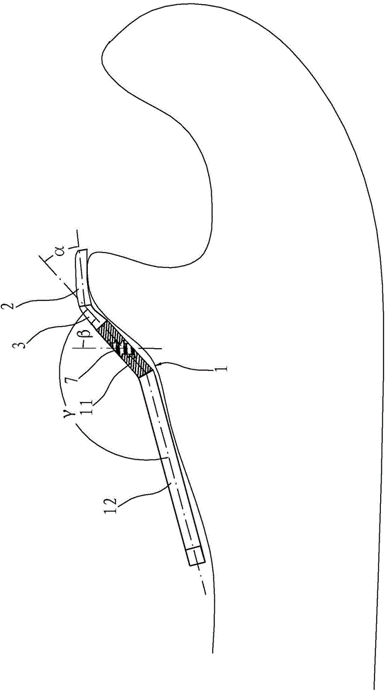 Ulna coracoid process lateral column steel plate