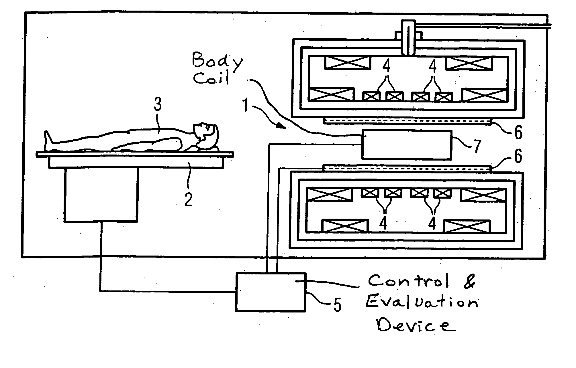 Magnetic resonance cylindrical body coil and method for generating a homogeneous RF field