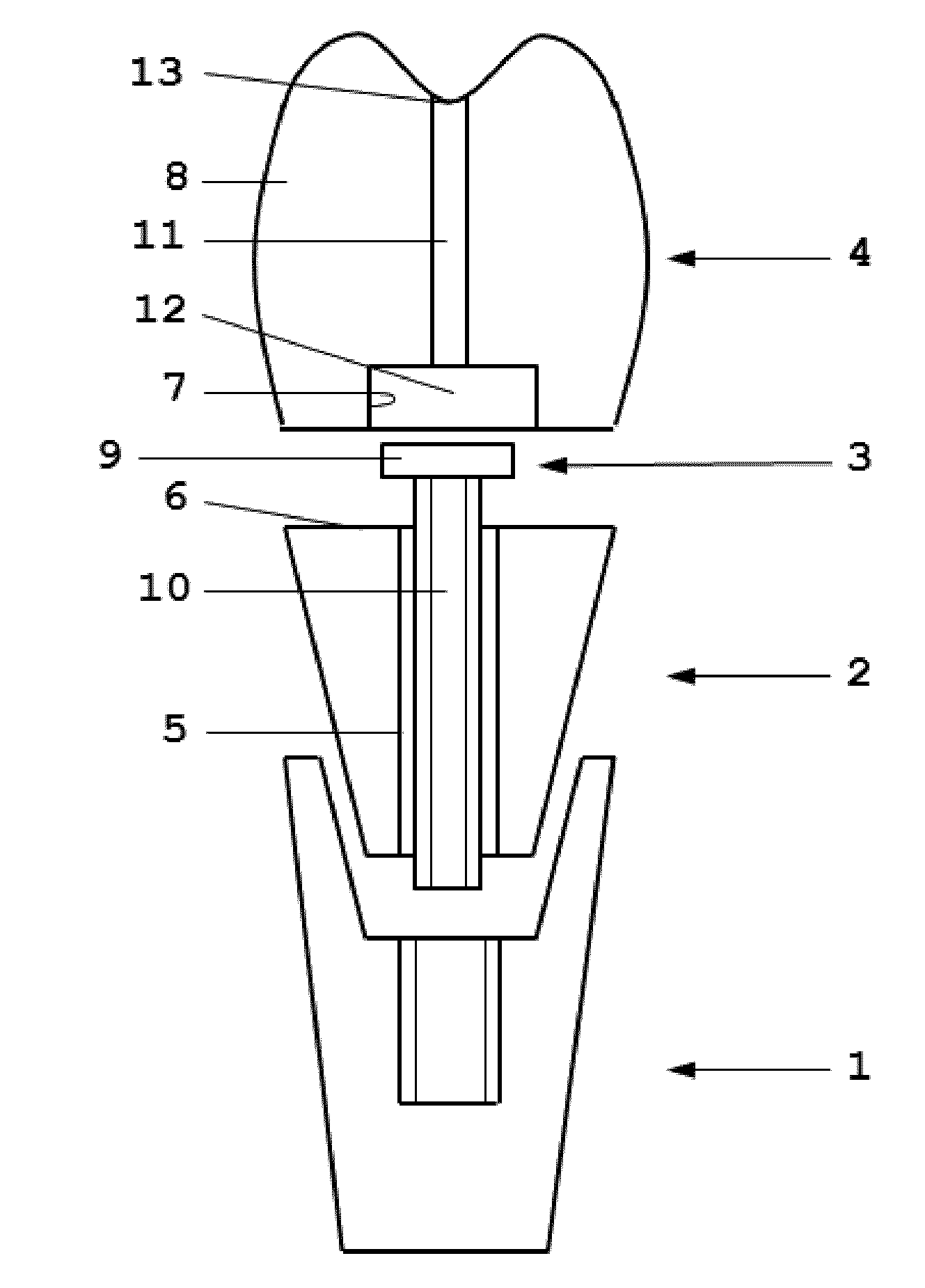 Dental kit-of-parts and method of assembling the same