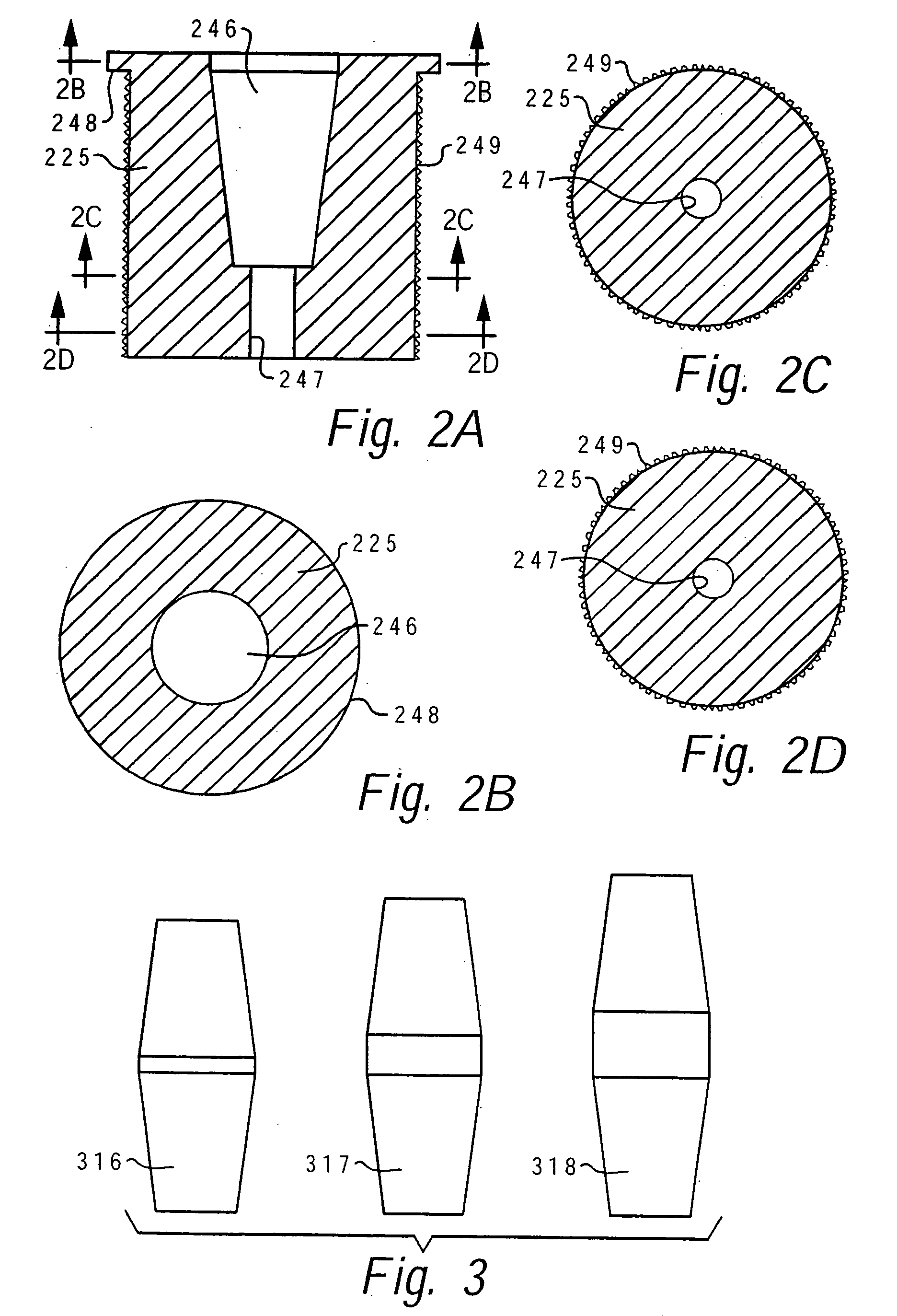 Method of resecting a femoral head for implantation of a femoral neck fixation prosthesis