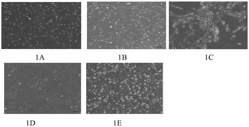 Serum-free medium and preparing method and application thereof