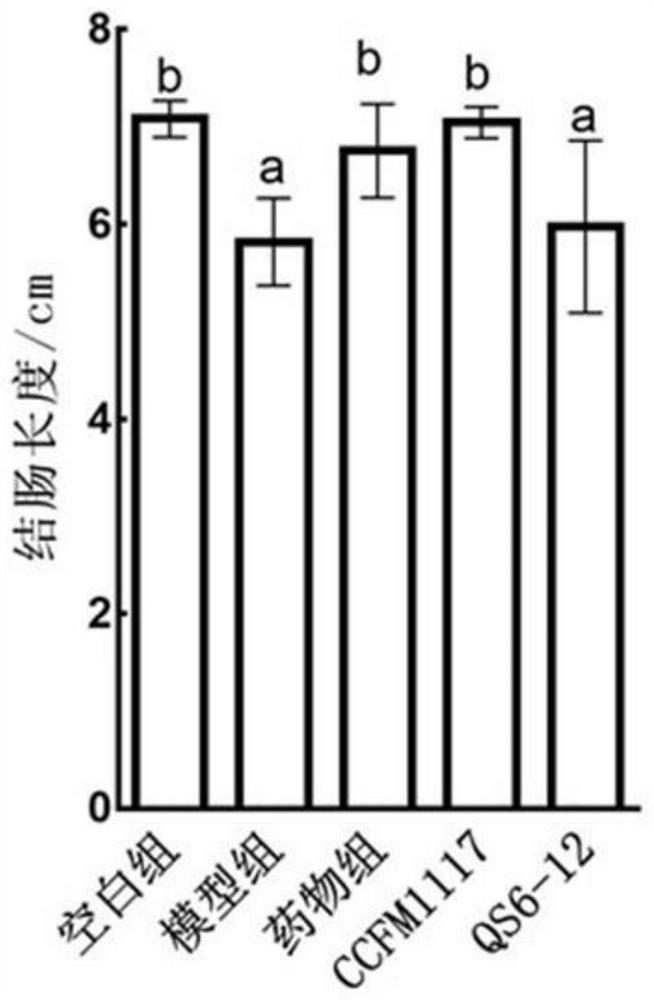 Lactobacillus plantarum for relieving ulcerative colitis and application thereof