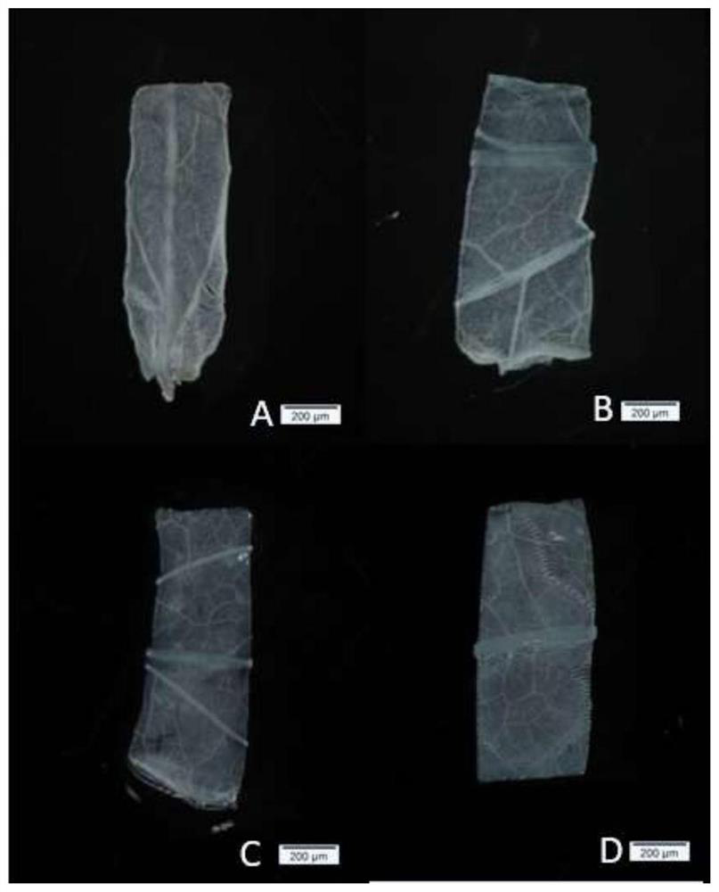 Method for genetic transformation of eucommia ulmoides by injection