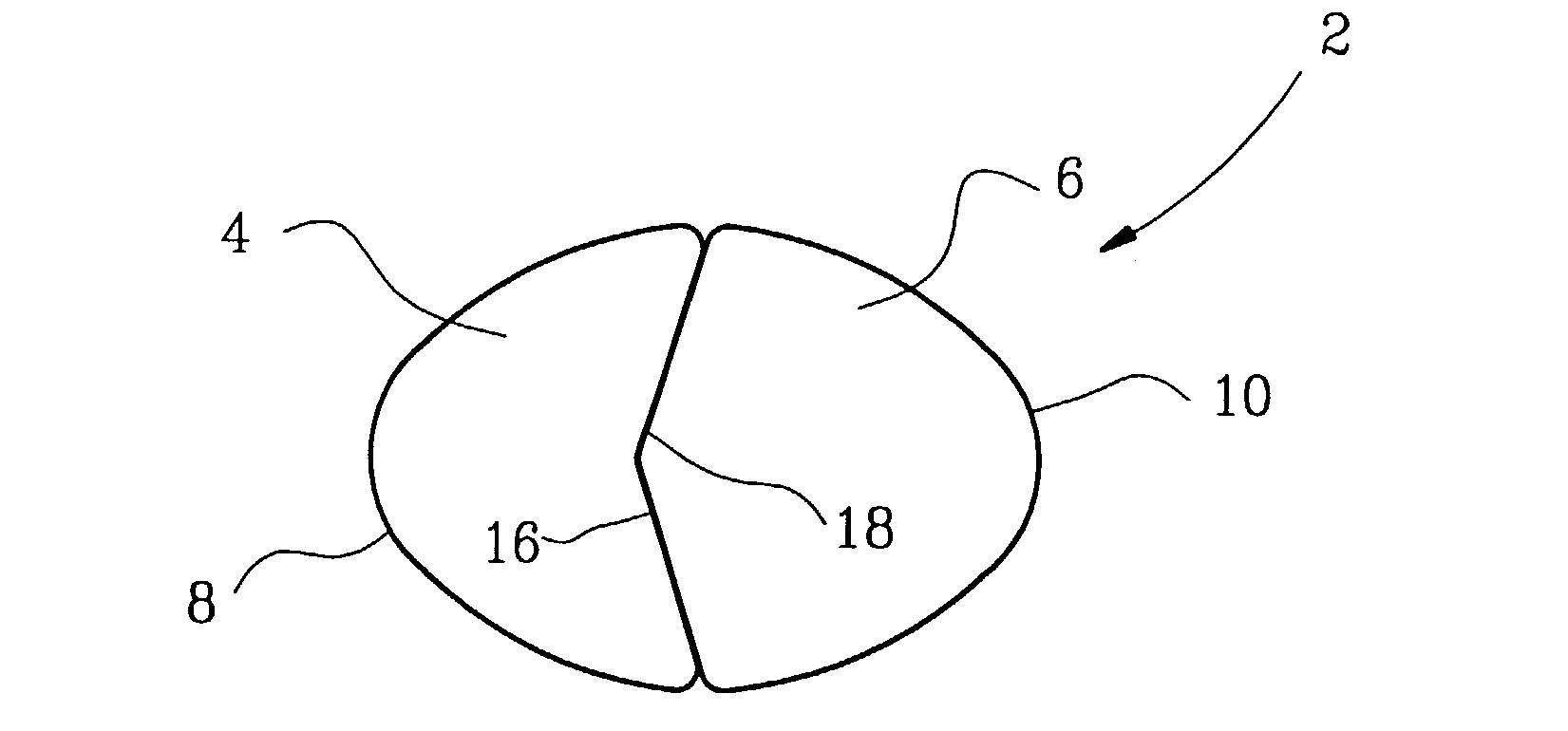 Orthodontic retainer elements