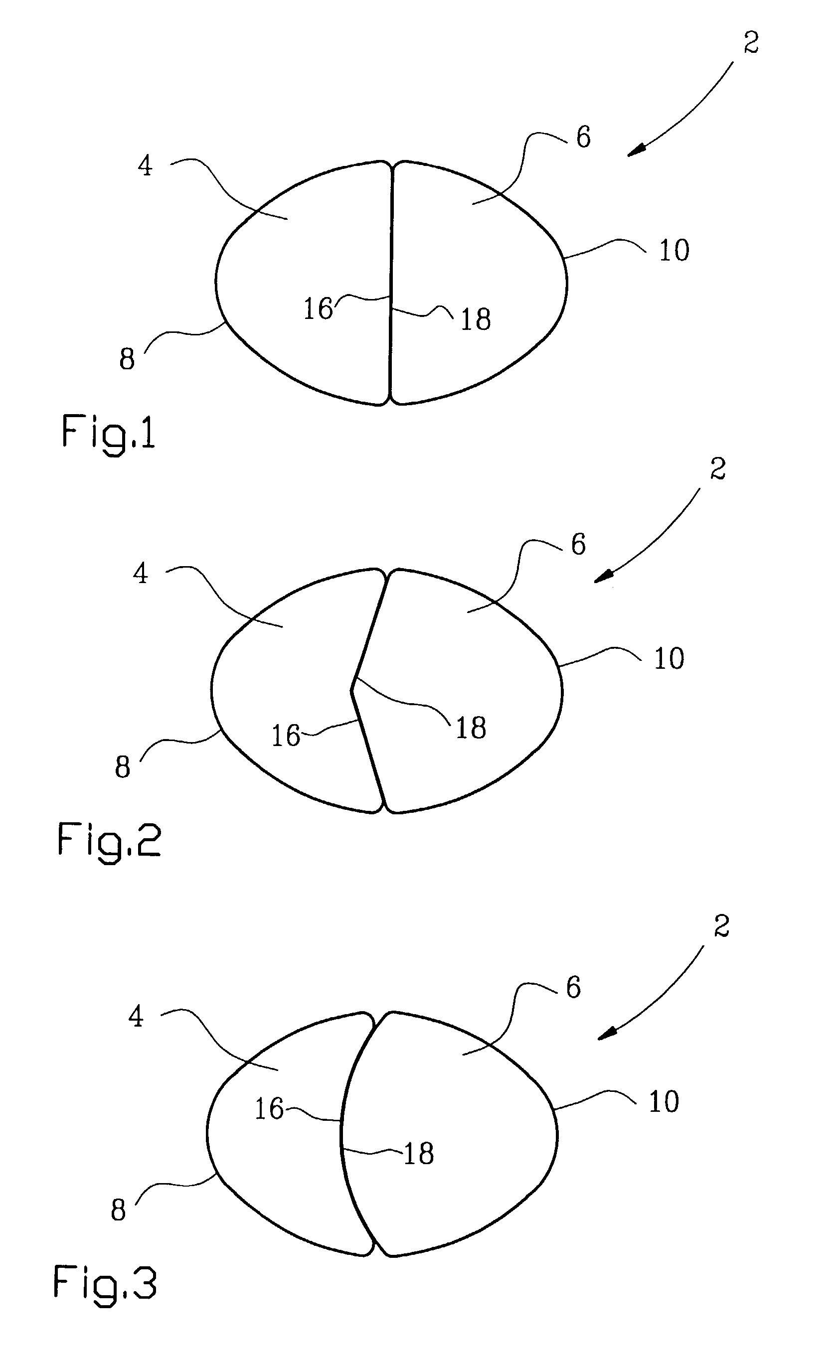 Orthodontic retainer elements