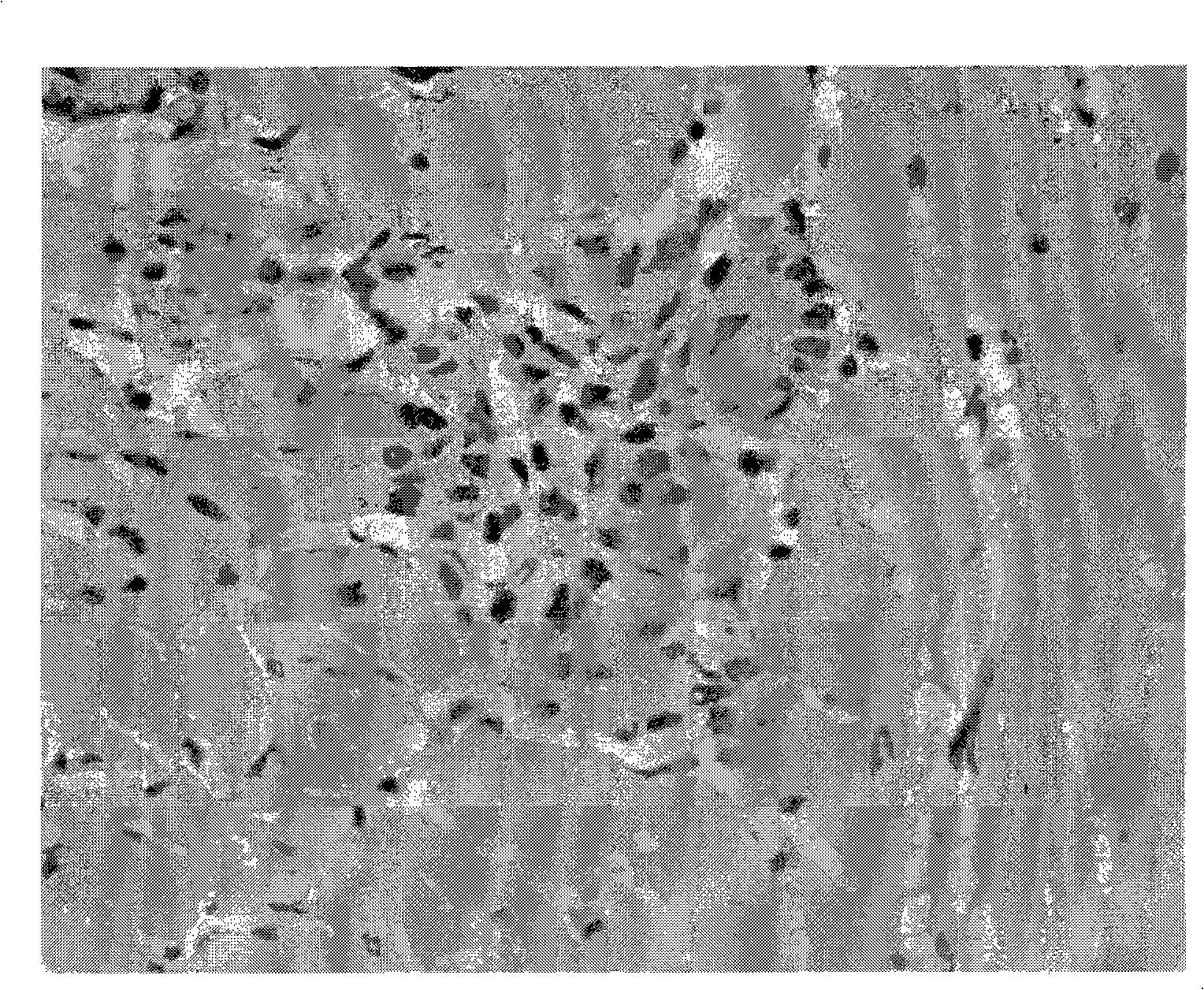 Anti-myocardial remodelling polypeptide, preparation method thereof, preparations and application thereof in preparation of anti-myocardial remodelling medicament