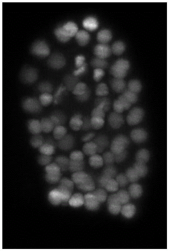 GPU (graphic processing unit) acceleration-based deconvolution algorithm for three-dimensional fluorescence microscopic image